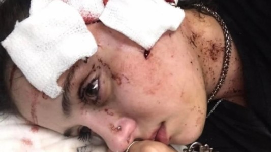 "Me arruinaron la cara": el drama de la camarera agredida por clientes en un bar de Mendoza