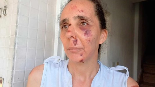 "No recuerdo si me caí, me empujaron o me arrastraron”, dijo la mujer asaltada en la Ciclovía