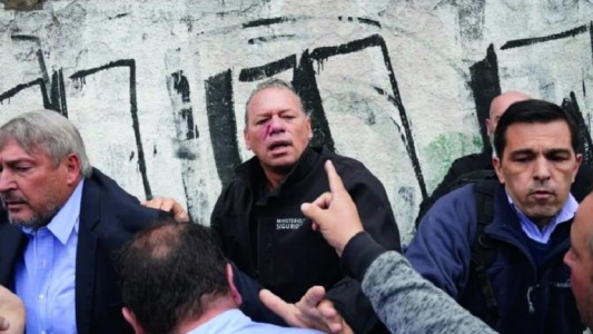 Agresión a Berni: la Justicia porteña identificó a más atacantes y podría haber nuevas detenciones