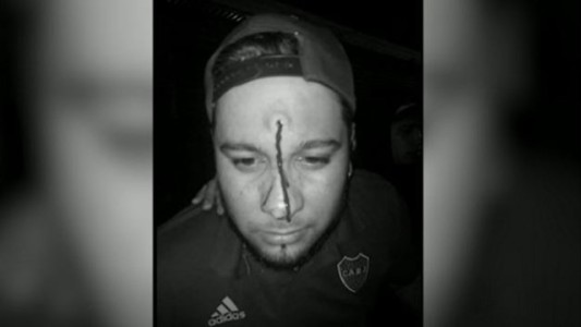 El grupo de cumbia tocaba en la calle y el cantante recibió un disparo en la frente