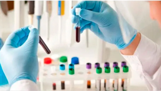 Bioquímicos: preocupación por aumento de insumos que supera el 400%