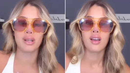 "Me tuvieron que dar puntos”: Julieta Poggio sufrió un accidente en un barco y lastimó la cara