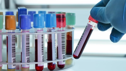 Bioquímicos aumentan precios de aranceles en Santa Fe