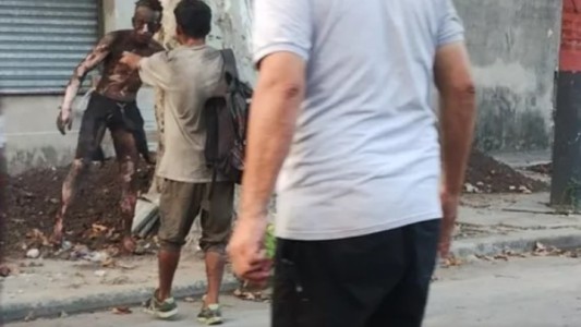 Quiso robar cables de alta tensión y terminó con el 90% del cuerpo quemado