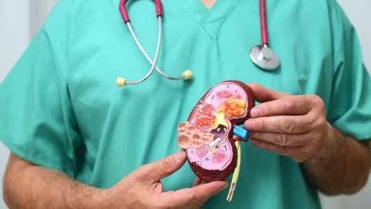 Hoy se conmemora el Día Mundial del Riñón