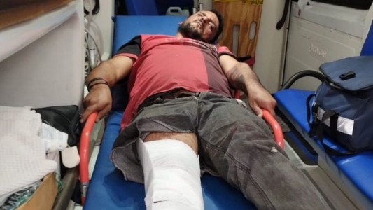 Rosario: atropellaron a "Kiko de zona sur", lo dejaron tirado y se dieron a la fuga