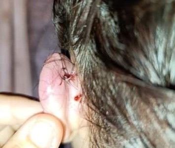 Agredieron a una joven en un boliche de Santa Fe