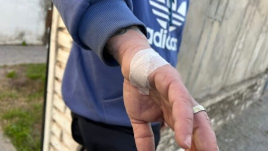 Ladrón hirió a joven cuando lo descubrió robando