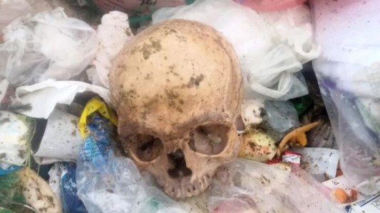 Impactante: recolectores de basura hallaron un cráneo humano