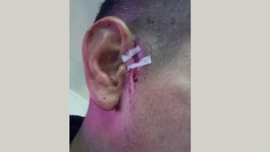 Habló el jugador herido: "Faltan un montón de controles en la Liga Santafesina"