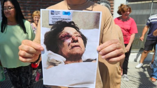 Mujer golpeada en entradera en Fomento 9 de Julio: ¿cuál es su estado de salud?