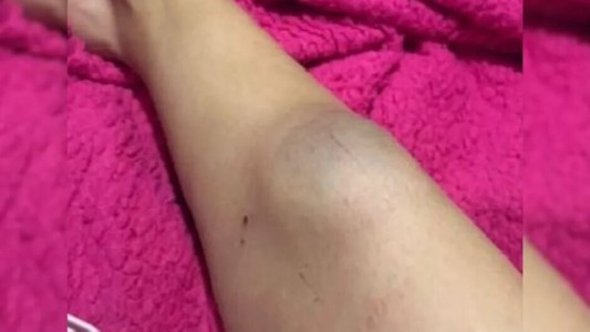 Un joven acusado de golpear a su pareja se entregó en una comisaría