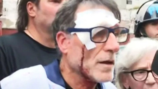 Se produjeron nuevos incidentes en la marcha de jubilados