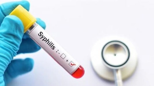 Preocupa el avance de la sífilis: se triplicaron los casos en adolescentes y recién nacidos