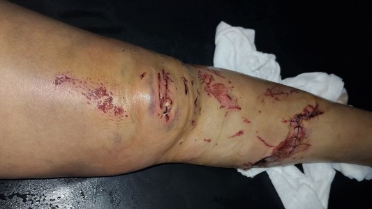 Piden testigos de un accidente ocurrido en la entrada de Alto Verde