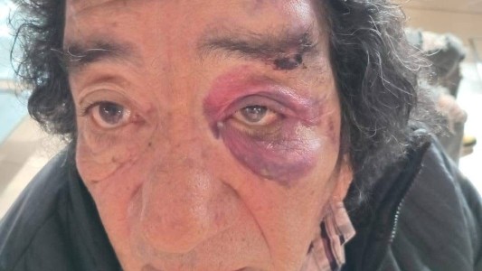 El músico Tito Frías fue atropellado y buscan al conductor que se dio a la fuga