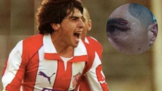 Probation para el hincha de Unión que golpeó al "Memo" Torres en el 15 de Abril