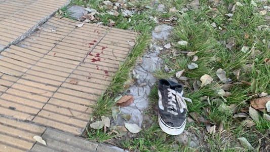 Herido de arma de fuego en Santa Rosa de Lima