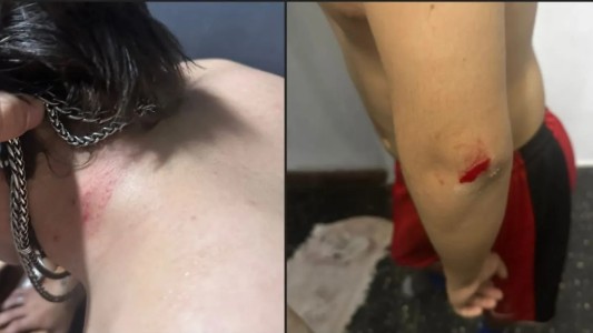 Golpearon con una pala a un adolescente de 15 años en Santo Tomé