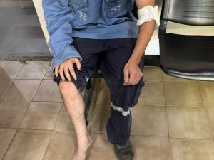 Un empleado de la EPE fue atacado por un grupo de perros