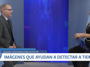 Diagnóstico por imágenes: estudios que ayudan a detectar a tiempo