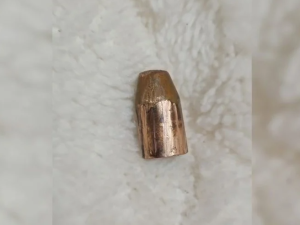 San José del Rincón: un adolescente de 13 años resultó herido al hacer explotar una bala de 9 mm con una pinza