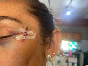 Dos mujeres detenidas por el ataque a la hermana del intendente de Rincón