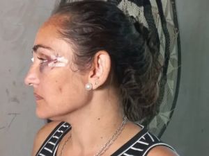 La hermana del intendente de Rincón lo denunció y señaló como autor intelectual de la golpiza que sufrió